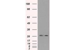 Image no. 1 for anti-Replication Protein A2, 32kDa (RPA2) antibody (ABIN1500734) (RPA2 抗体)