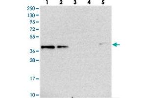 Western blot analysis of Lane 1: RT-4, Lane 2: U-251 MG, Lane 3: Human Plasma, Lane 4: Liver, Lane 5: Tonsil with TMEM164 polyclonal antibody  at 1:250-1:500 dilution. (TMEM164 抗体)