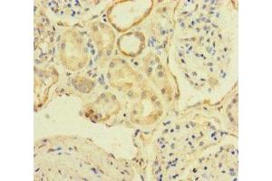 Immunohistochemistry of paraffin-embedded human kidney tissue using ABIN7171622 at dilution of 1:100 (TBC1D24 抗体  (AA 1-169))