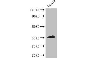 Western Blot Positive WB detected in: Mouse brain tissue All lanes: ZFP42 antibody at 3 μg/mL Secondary Goat polyclonal to rabbit IgG at 1/50000 dilution Predicted band size: 35 kDa Observed band size: 35 kDa (ZFP42 抗体  (AA 6-68))