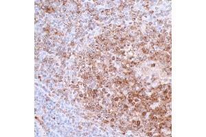 Immunohistochemistry (IHC) image for anti-HLA-DR-gamma (CD74) antibody (ABIN7449435) (CD74 抗体)
