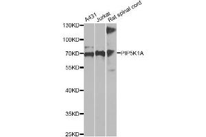Western blot analysis of extracts of various cell lines, using PIP5K1A antibody (ABIN6292233) at 1:1000 dilution. (PIP5K1A 抗体)