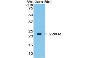 Western blot analysis of the recombinant protein. (TLR7 抗体  (AA 887-1036))