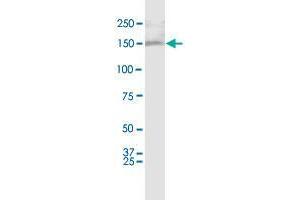 Western Blotting (WB) image for anti-Additional Sex Combs Like 1 (ASXL1) (AA 1-84) antibody (ABIN949894)