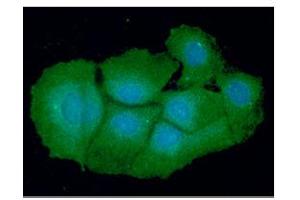 ICC/IF analysis of VTA1 in Hep3B cells line, stained with DAPI (Blue) for nucleus staining and monoclonal anti-human VTA1 antibody (1:100) with goat anti-mouse IgG-Alexa fluor 488 conjugate (Green). (VTA1 抗体)