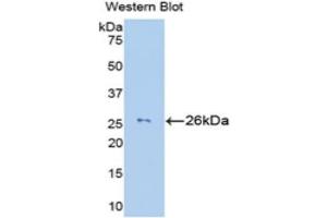 Western Blotting (WB) image for anti-Granzyme M (Lymphocyte Met-Ase 1) (GZMM) (AA 26-257) antibody (ABIN1172881) (GZMM 抗体  (AA 26-257))