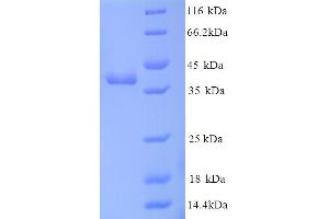 SDS-PAGE (SDS) image for Chemokine (C-C Motif) Ligand 2 (CCL2) (AA 211-551) protein (His tag) (ABIN5714154)