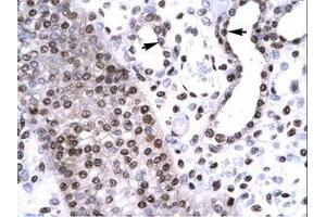 Image no. 1 for anti-BarH-Like Homeobox 2 (BARHL2) (AA 165-214) antibody (ABIN6735794) (BARHL2 抗体  (AA 165-214))