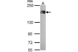 WB Image Sample (30 ug of whole cell lysate) A: A431 , 5% SDS PAGE PB1 antibody antibody diluted at 1:500 (Polybromo 1 抗体  (N-Term))