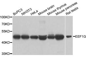 Western blot analysis of extracts of various cell lines, using EEF1G antibody. (EEF1G 抗体  (AA 168-437))