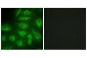 Immunofluorescence analysis of HeLa cells, using DGKI antibody. (DGKI 抗体  (C-Term))