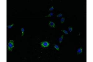 Immunofluorescent analysis of HepG2 cells using ABIN7166799 at dilution of 1:100 and Alexa Fluor 488-congugated AffiniPure Goat Anti-Rabbit IgG(H+L) (SVOPL 抗体  (AA 73-129))