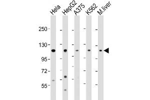 Western Blot at 1:2000 dilution Lane 1: Hela whole cell lysate Lane 2: HepG2 whole cell lysate Lane 3: A375 whole cell lysate Lane 4: K562 whole cell lysate Lane 5: mouse liver lysate Lysates/proteins at 20 ug per lane. (IDE 抗体  (AA 406-435))