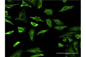 Immunofluorescence of monoclonal antibody to FABP4 on HeLa cell. (FABP4 抗体  (AA 1-132))