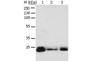 Western Blot analysis of 293T cell and Mouse brain tissue, A549, Hela, A172 and HT-29 cell using RAB6A Polyclonal Antibody at dilution of 1:650 (RAB6A 抗体)