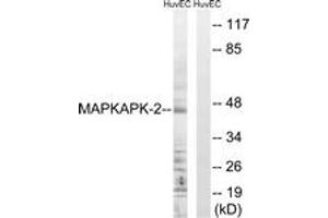 Western blot analysis of extracts from HuvEc cells, treated with Adriamycin 0. (MAPKAP Kinase 2 抗体  (AA 188-237))