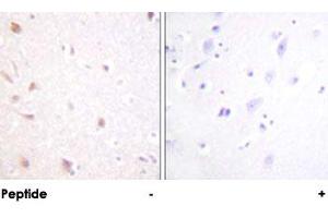 Immunohistochemical analysis of paraffin-embedded human brain tissue using MKI67IP polyclonal antibody . (NIFK 抗体)