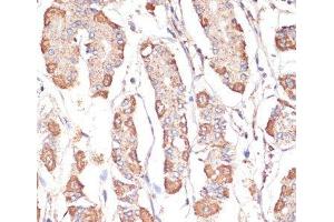 Immunohistochemistry (Paraffin-embedded Sections) (IHC (p)) image for anti-ATP Synthase, H+ Transporting, Mitochondrial F1 Complex, alpha Subunit 1, Cardiac Muscle (ATP5A1) antibody (ABIN7010884)