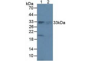 Western blot analysis of (1) Rat Brain Tissue and (2) Rat Lung Tissue. (Peroxiredoxin 4 抗体  (AA 6-249))