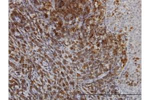 Immunostaining (ISt) image for anti-ATPase, Ca++ Transporting, Ubiquitous (ATP2A3) (AA 501-620) antibody (ABIN559999)