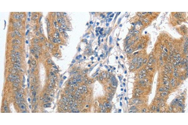 Centromere Protein C Pseudogene 1 (CENPCP1) 抗体