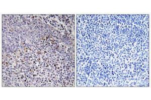 Immunohistochemistry (IHC) image for anti-Holocytochrome C Synthase (HCCS) (Internal Region) antibody (ABIN1850244) (HCCS 抗体  (Internal Region))