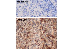 IHC of human appendix using anti-CD4 antibody and FFPE tissue after heat-induced antigen retrieval. (CD4 抗体)