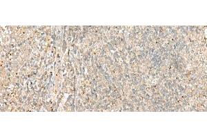 Immunohistochemistry of paraffin-embedded Human tonsil tissue using EIF2AK1 Polyclonal Antibody at dilution of 1:45(x200) (EIF2AK1 抗体)