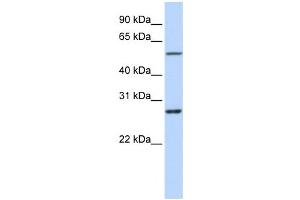 Western Blotting (WB) image for anti-Ring Finger Protein 217 (RNF217) antibody (ABIN2458748) (RNF217 抗体)
