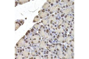 Immunohistochemistry of paraffin-embedded rat pancreas using LMNB2 antibody at dilution of 1:200 (400x lens). (Lamin B2 抗体)