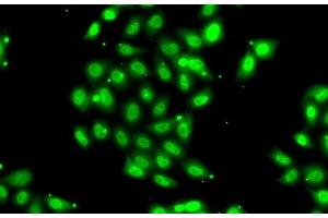 Immunofluorescence analysis of U2OS cells using PIAS3 Polyclonal Antibody (PIAS3 抗体)