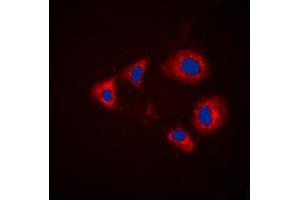 Immunofluorescence (IF) image for anti-Aurora Kinase A (AURKA) (pSer288) antibody (ABIN7301500)