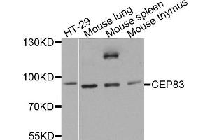 Western blot analysis of extracts of various cell lines, using CEP83 antibody. (CCDC41 抗体)