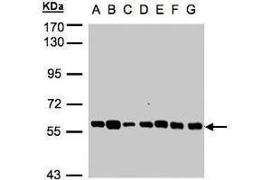 WB Image Sample(30 ug whole cell lysate) A: 293T B: A431 , C: H1299 D: HeLa S3 , E: Hep G2 , F: MOLT4 , G: Raji , 7. (TULP1 抗体)