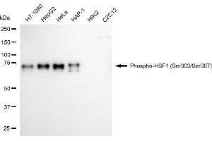Western blotting analysis using phospho-HSF1 (Ser303/Ser307) antibody (ABIN7798864). (Recombinant HSF1 抗体  (pSer303, pSer307))