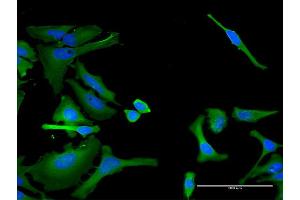Immunofluorescence of monoclonal antibody to ITGA1 on HeLa cell. (Integrin alpha 1 抗体  (AA 951-1059))