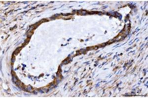 IHC analysis of GIGYF2 using anti-GIGYF2 antibody (ABIN7601679). (GIGYF2 抗体  (AA 413-1299))