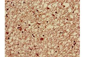 Immunohistochemistry of paraffin-embedded human brain tissue using ABIN7143166 at dilution of 1:100 (Activator of Basal Transcription 1 抗体  (AA 197-270))