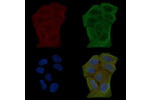 ABIN6255406 and ABIN6267612 staining Hela cells(30 min of UV treatment) by IF/ICC. (LIPE 抗体  (pSer552))