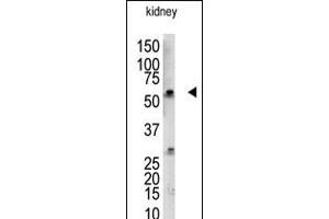 Antibody is used in Western blot to detect UBCE7IP3 in mouse kidney tissue lysate. (RBCK1 抗体  (N-Term))