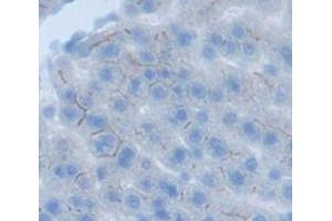 Figure. (Angiotensin II Type-1 Receptor 抗体  (AA 263-359))