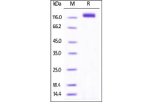Biotinylated Human VEGF R2, His Tag on SDS-PAGE under reducing (R) condition.