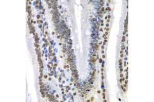 Immunohistochemistry of paraffin-embedded mouse Intestine using SEPT7 antibody (ABIN5974146) at dilution of 1/100 (40x lens). (Septin 7 抗体)