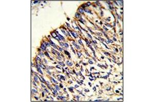 Immunohistochemistry (Paraffin-embedded Sections) (IHC (p)) image for anti-Hydroxyacyl-Coenzyme A Dehydrogenase/3-Ketoacyl-Coenzyme A Thiolase/enoyl-Coenzyme A Hydratase (Trifunctional Protein), alpha Subunit (HADHA) (AA 734-763), (C-Term) antibody (ABIN453085)