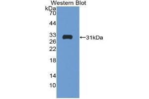 Western blot analysis of the recombinant protein. (Follistatin 抗体  (AA 35-283))