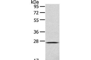 Western Blot analysis of 293T cell using CLEC4D Polyclonal Antibody at dilution of 1:123 (CLEC4D 抗体)