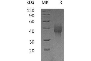 Western Blotting (WB) image for Tumor Necrosis Factor Receptor Superfamily, Member 4 (TNFRSF4) protein (His tag) (ABIN7320946) (TNFRSF4 Protein (His tag))