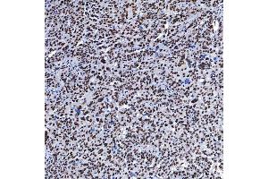 IHC analysis of SF3B3 using anti-SF3B3 antibody (ABIN7602378).