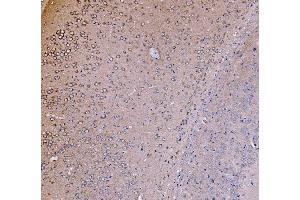 IHC analysis of PI 3 Kinase p85 alpha/PIK3R1 using anti-PI 3 Kinase p85 alpha/PIK3R1 antibody (ABIN7599781).