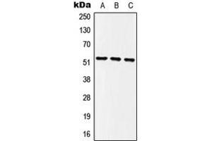 Western blot analysis of MINA53 expression in HEK293T (A), NIH3T3 (B), PC12 (C) whole cell lysates. (MINA 抗体  (Center))